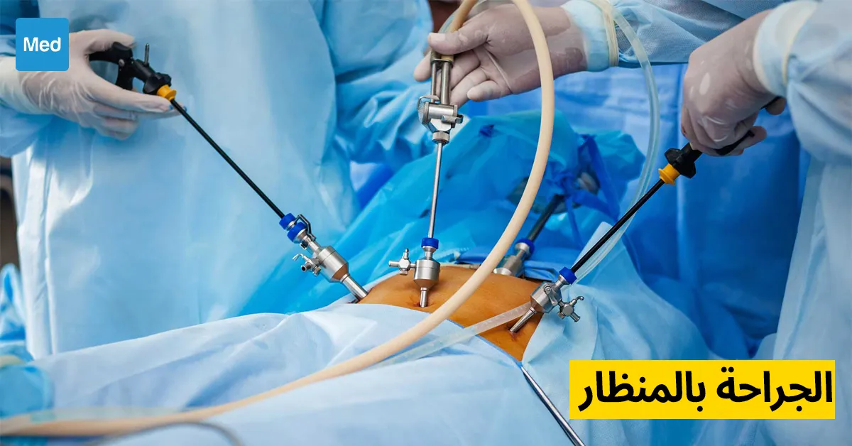 الجراحة بالمنظار